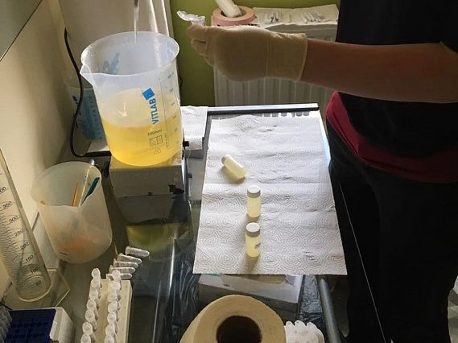 Measuring cup with urine