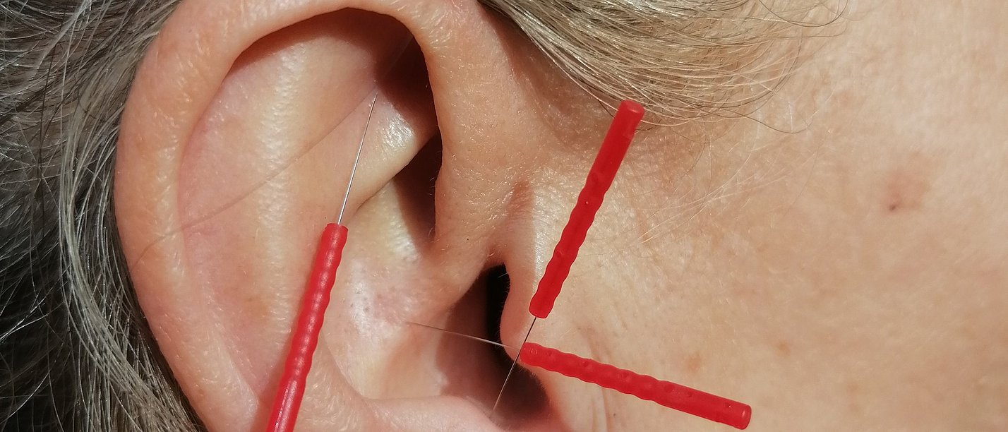 Symbolbild Amerikanische Battlefield Akupunktur