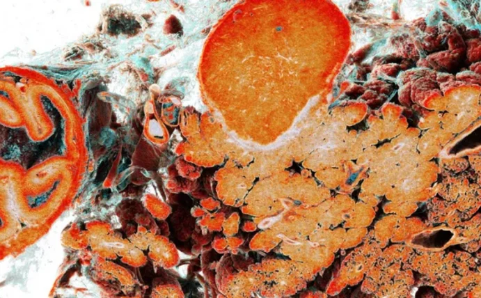 Wissenschaftliche Aufnahme einer Bauchspeicheldrüse und eines Zwölffingerdarms.