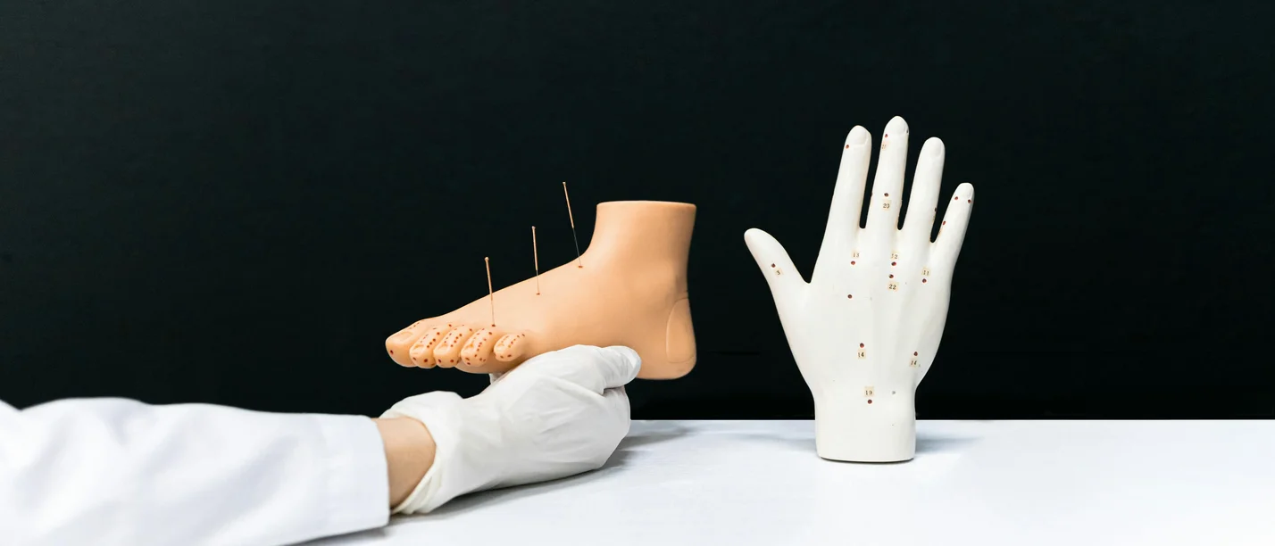 Symbolbild Akupunktur