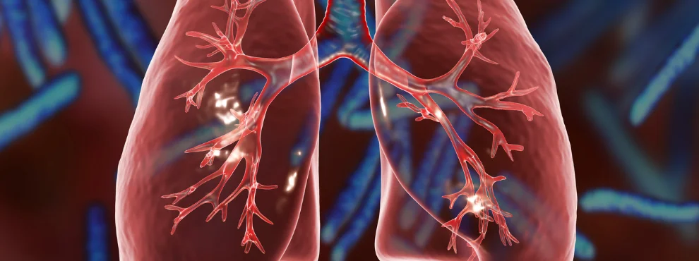 Symbolbild Lunge