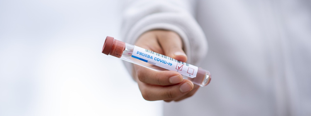 Prof. Karagiannidis wurde in den Expert:innenrat berufen, um die Bundesregierung über aktuelle wissenschaftliche Erkenntnisse zum Coronavirus SARS-CoV-2 zu beraten. (Foto: pixabay | fernandozhiminaicela) Eine Hand hält ein geschlossenes Reagenzglas mit der Aufschrift Prueba COVID-19 in die Kamera.