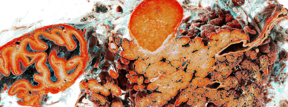 Für seine beeindruckend präzisen und kunstvollen Aufnahmen aus dem Inneren des menschlichen Körpers wird Prof. Dr. Maximilian Ackermann ausgezeichnet.(Foto: Maximilian Ackermann) Wissenschaftliche Aufnahme einer Bauchspeicheldrüse und eines Zwölffingerdarms.